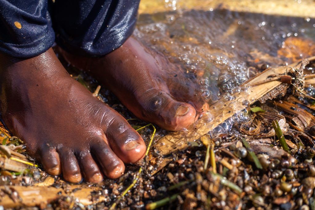 bare feet at Masese